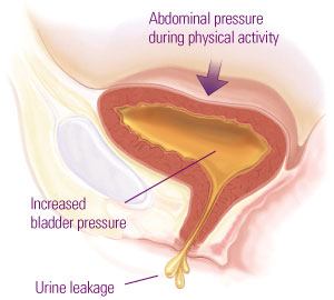 https://physiolaura.com/wp-content/uploads/2016/11/11-SUI-medfriendly.com_.jpg