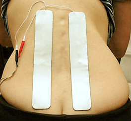 Using a TENS Unit During Labor